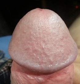 Picture of a large penis