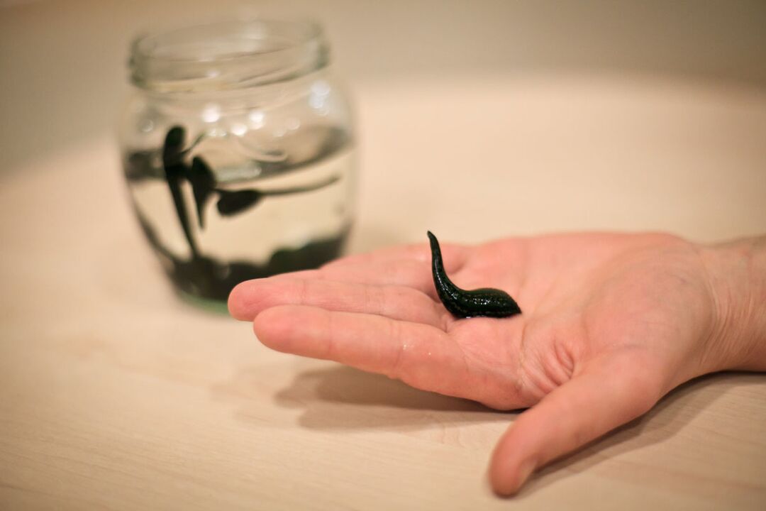 Leeches will serve as raw materials for the production of a cream that stimulates the growth of the penis